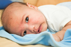 Birth Injury and Negligence Attorneys New York